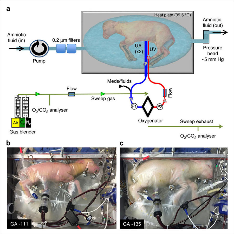 Artificial Wombs Successfully Pass 1st Test, Human Trials Could Begin Within 3 Years