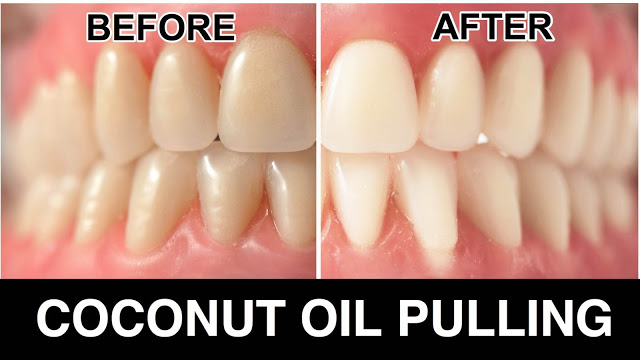 Oil Pulling: Research Finally Reveals What Some Have Known All Along