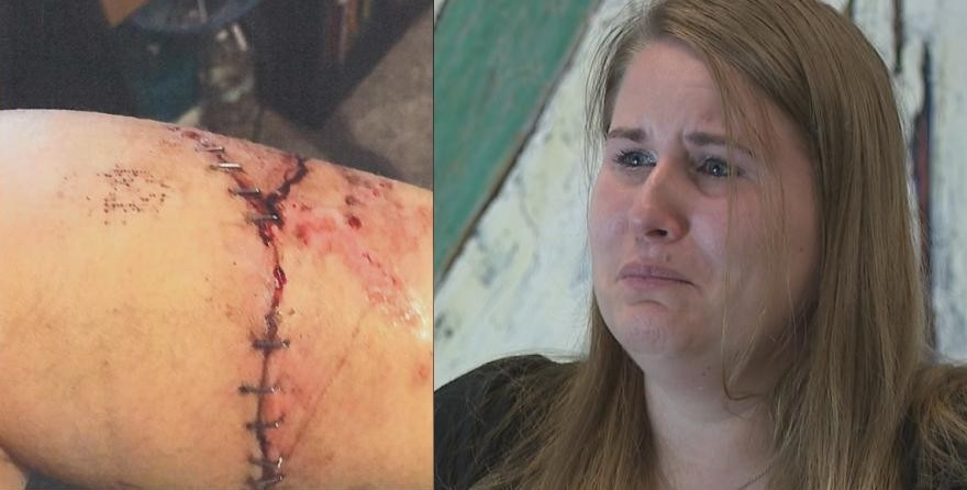 [WATCH] Woman Bitten by Police Canine Sues Newark Police Department