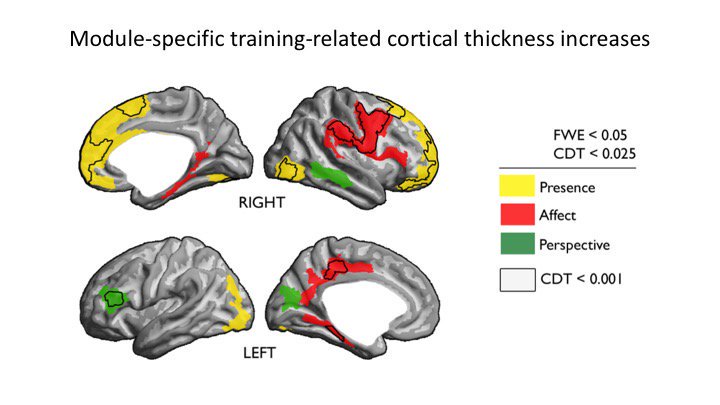 New Study Shows How Specific Types Of Meditation Affect Different Areas Of The Brain