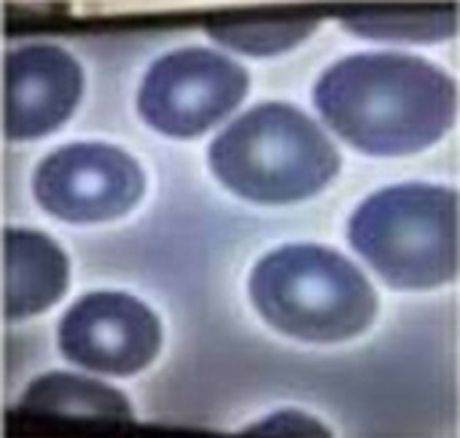 Check this Out: Live Blood Analysis After Vax Cells-2