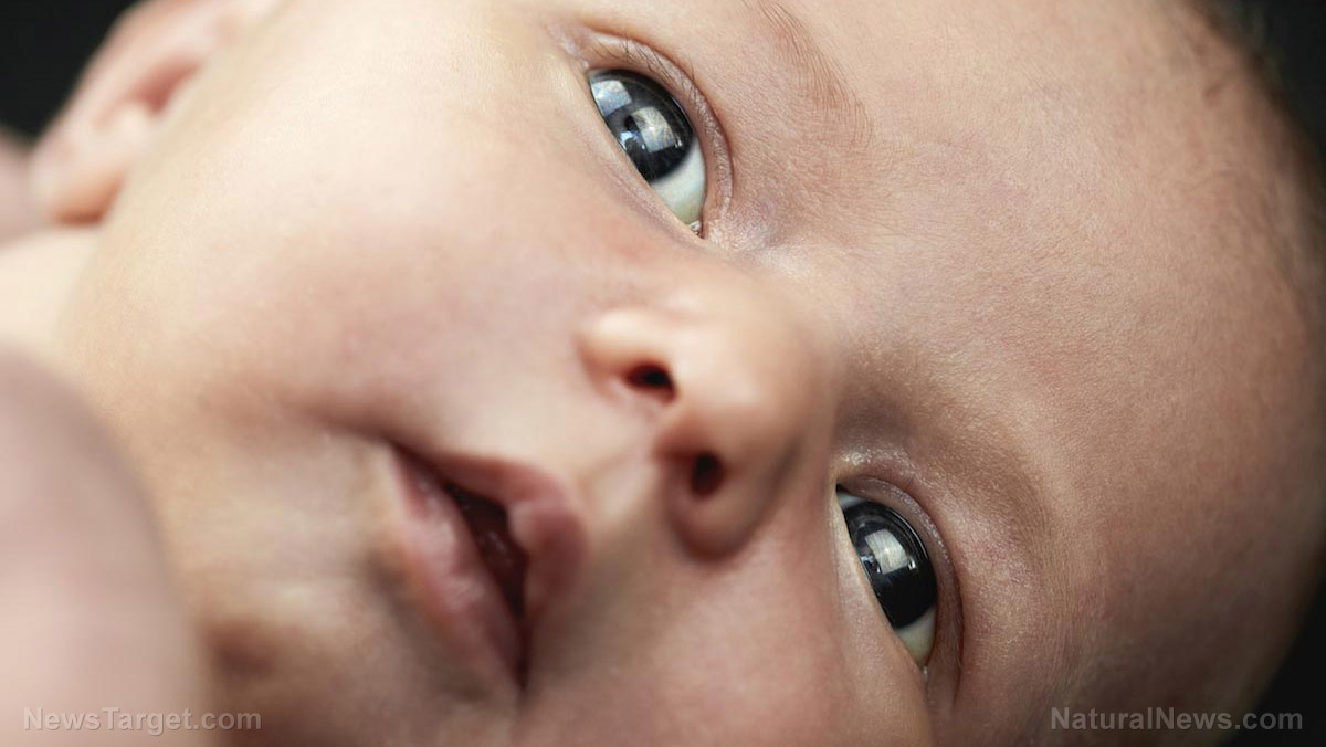 Following COVID treatment with antiviral drug favipiravir, baby boy’s dark-brown eyes turned b...